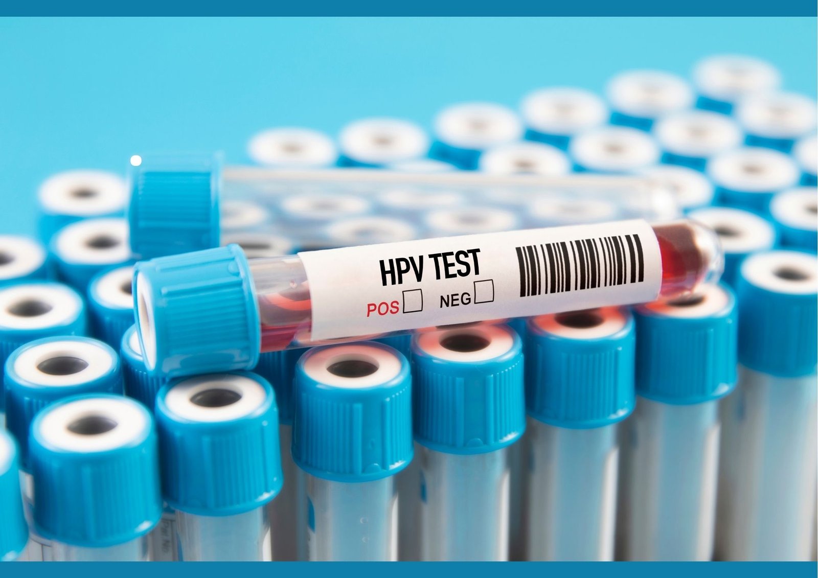 Hpv szczepienia na dolnymslasku